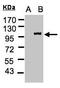 Lgl2 antibody, LS-C185927, Lifespan Biosciences, Western Blot image 