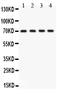 Potassium Calcium-Activated Channel Subfamily M Alpha 1 antibody, PB9227, Boster Biological Technology, Western Blot image 