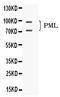 Promyelocytic Leukemia antibody, PB10085, Boster Biological Technology, Western Blot image 