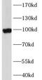 ATP Binding Cassette Subfamily G Member 1 antibody, FNab00042, FineTest, Western Blot image 