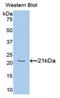 Plasma protease C1 inhibitor antibody, MBS2001471, MyBioSource, Western Blot image 