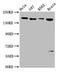 LIF receptor antibody, CSB-PA012929LA01HU, Cusabio, Western Blot image 
