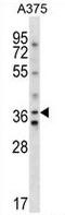 Arginine Vasopressin Receptor 1A antibody, AP50317PU-N, Origene, Western Blot image 