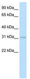 Homeobox protein Hox-D3 antibody, TA342270, Origene, Western Blot image 