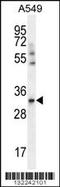 ANT2 antibody, TA324481, Origene, Western Blot image 