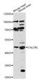 CALCRL antibody, abx125596, Abbexa, Western Blot image 