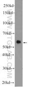 Dipeptidyl peptidase 9 antibody, 11568-1-AP, Proteintech Group, Western Blot image 
