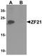 Zinc finger FYVE domain-containing protein 21 antibody, orb137337, Biorbyt, Western Blot image 