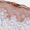 Ribonuclease 7 antibody, NBP2-52884, Novus Biologicals, Immunohistochemistry paraffin image 