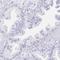 Sentan, Cilia Apical Structure Protein antibody, HPA058399, Atlas Antibodies, Immunohistochemistry paraffin image 