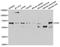 CD5 Molecule antibody, A6882, ABclonal Technology, Western Blot image 
