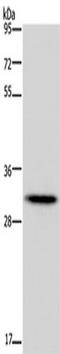 Homeobox B8 antibody, TA351257, Origene, Western Blot image 