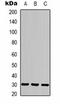 Calcium Voltage-Gated Channel Auxiliary Subunit Gamma 3 antibody, orb323238, Biorbyt, Western Blot image 