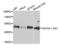 Mitogen-Activated Protein Kinase 8 antibody, AHP2495, Bio-Rad (formerly AbD Serotec) , Western Blot image 