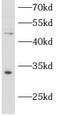 ATPase family AAA domain-containing protein 1 antibody, FNab00654, FineTest, Western Blot image 