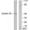 Keratin 20 antibody, A02828-1, Boster Biological Technology, Western Blot image 