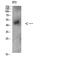 Tachykinin Receptor 3 antibody, STJ98637, St John