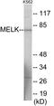 Maternal Embryonic Leucine Zipper Kinase antibody, EKC1811, Boster Biological Technology, Western Blot image 
