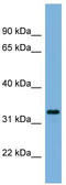 Peroxisomal Biogenesis Factor 11 Alpha antibody, TA339383, Origene, Western Blot image 