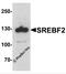 Sterol Regulatory Element Binding Transcription Factor 2 antibody, 7855, ProSci Inc, Western Blot image 