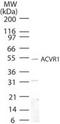 Activin A Receptor Type 1 antibody, PA1-41185, Invitrogen Antibodies, Western Blot image 