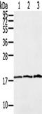 Leukocyte Associated Immunoglobulin Like Receptor 2 antibody, TA350703, Origene, Western Blot image 