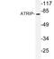 ATR Interacting Protein antibody, LS-C176386, Lifespan Biosciences, Western Blot image 