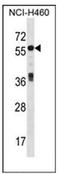 Islet cell autoantigen 1 antibody, AP52139PU-N, Origene, Western Blot image 