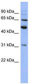 Proteasome 26S Subunit, Non-ATPase 3 antibody, TA342175, Origene, Western Blot image 