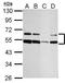 ST8 Alpha-N-Acetyl-Neuraminide Alpha-2,8-Sialyltransferase 4 antibody, GTX125904, GeneTex, Western Blot image 