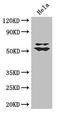 Kruppel Like Factor 5 antibody, orb46315, Biorbyt, Western Blot image 