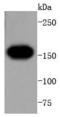 Fms Related Tyrosine Kinase 1 antibody, A00534-3, Boster Biological Technology, Western Blot image 