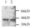 Dual specificity mitogen-activated protein kinase kinase 3 antibody, GTX25428, GeneTex, Western Blot image 