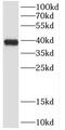 Cylicin 2 antibody, FNab02141, FineTest, Western Blot image 