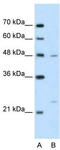 BSD Domain Containing 1 antibody, TA344149, Origene, Western Blot image 