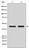 C-C Motif Chemokine Receptor 7 antibody, M00390, Boster Biological Technology, Western Blot image 