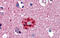 POD1 antibody, ARP33421_P050, Aviva Systems Biology, Immunohistochemistry frozen image 