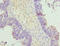 Homocysteine Inducible ER Protein With Ubiquitin Like Domain 1 antibody, LS-C675858, Lifespan Biosciences, Immunohistochemistry paraffin image 