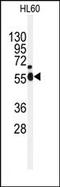 NIMA Related Kinase 2 antibody, AP15022PU-N, Origene, Western Blot image 