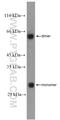 Deoxyguanosine kinase, mitochondrial antibody, 16314-1-AP, Proteintech Group, Western Blot image 
