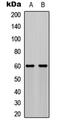 Akt antibody, LS-C358423, Lifespan Biosciences, Western Blot image 