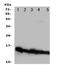 NADH:Ubiquinone Oxidoreductase Subunit A1 antibody, LS-C312816, Lifespan Biosciences, Western Blot image 