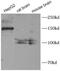 Collagen Type III Alpha 1 Chain antibody, FNab01839, FineTest, Western Blot image 