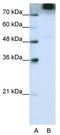 Eukaryotic Translation Initiation Factor 3 Subunit B antibody, TA345851, Origene, Western Blot image 