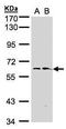 Flavin Containing Dimethylaniline Monoxygenase 1 antibody, TA308880, Origene, Western Blot image 