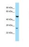 Fas Associated Factor Family Member 2 antibody, NBP1-98272, Novus Biologicals, Western Blot image 