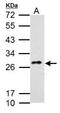 C-Type Lectin Domain Containing 5A antibody, NBP2-43607, Novus Biologicals, Western Blot image 