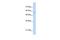 Phosphatidylglycerophosphate Synthase 1 antibody, GTX46171, GeneTex, Western Blot image 