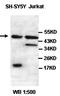 Homeobox Containing 1 antibody, orb77691, Biorbyt, Western Blot image 