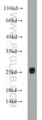 Retinal G Protein Coupled Receptor antibody, 11904-1-AP, Proteintech Group, Western Blot image 